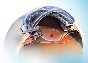 低温日本午夜福利视频APP人工晶体状