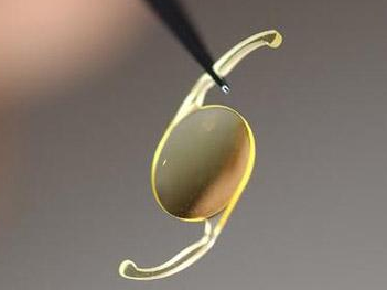 低温日本午夜福利视频APP技术提高人工晶状体的亲水性，解决术后炎症问题-午夜精品久久久午夜电影网站机